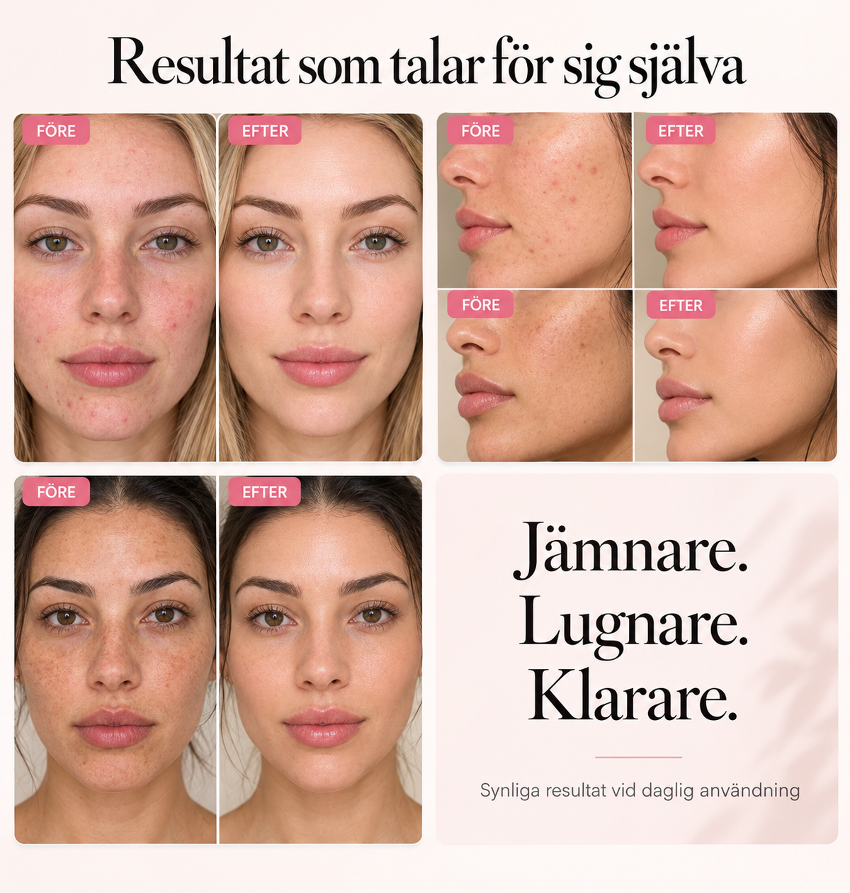 Ansiktskräm mot pigmentfläckar