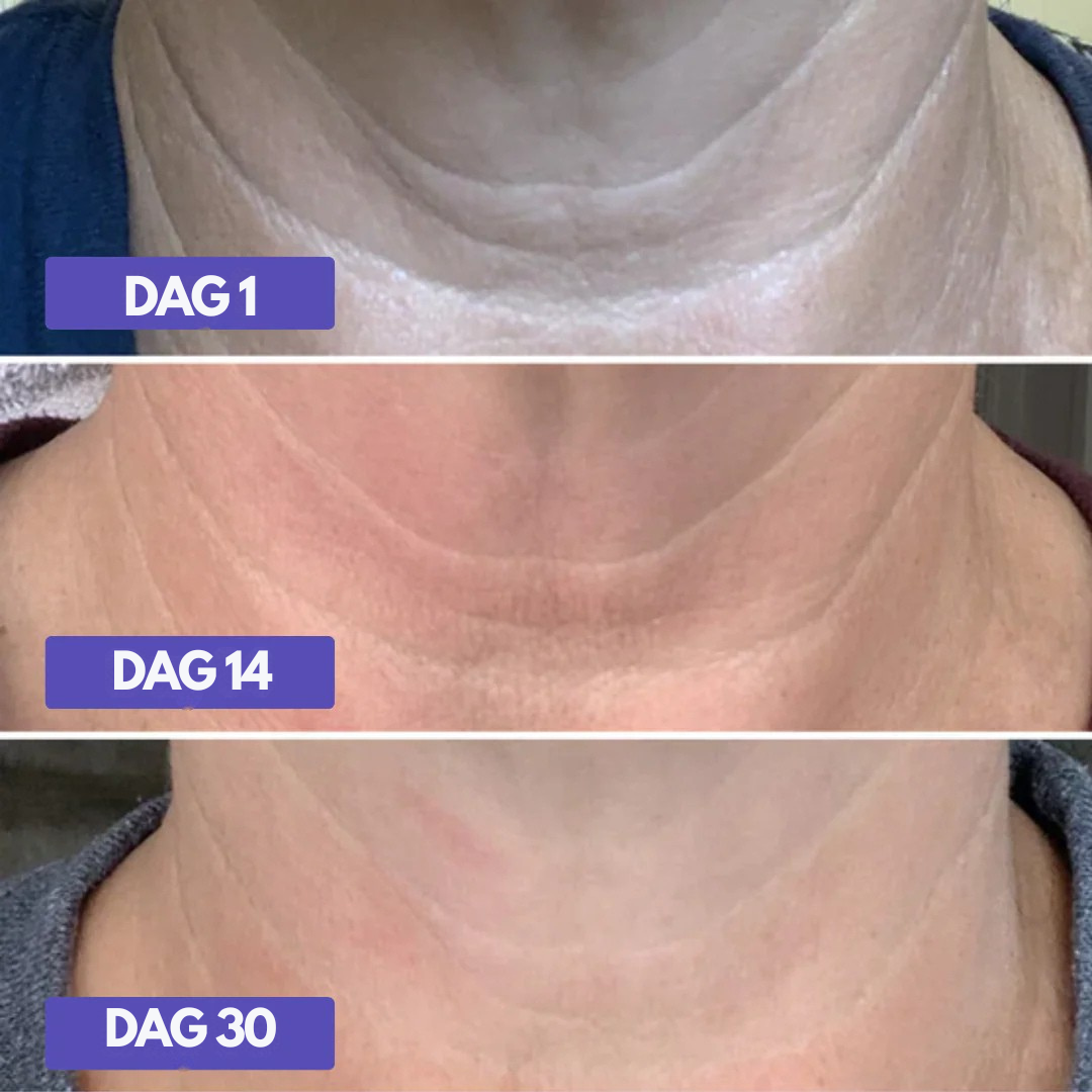 Uppstramande Hals & Dekolletage-kräm