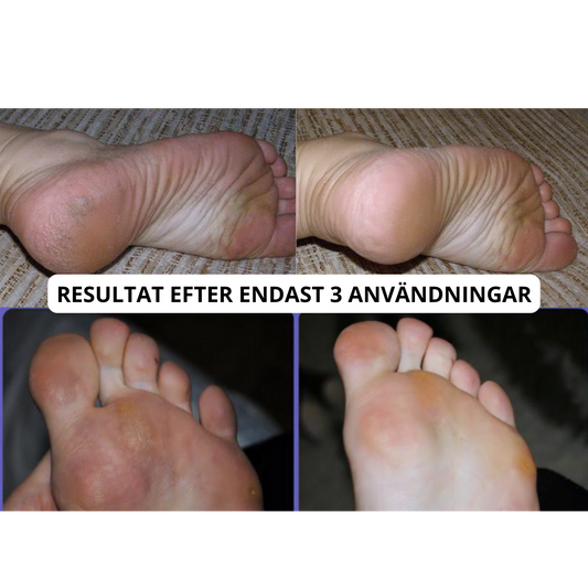 Elektrisk Fotfil Pro