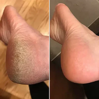 Bliss Silk Pro 2 - myke føtter uten dyre salongbesøk