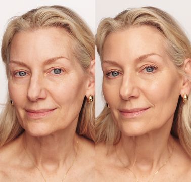 Barvena Foundation™ – For en jævn og naturlig hudtone