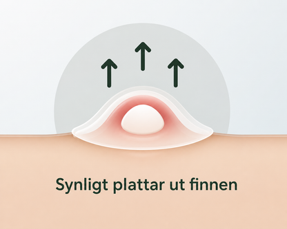 Akneplaster – lad huden komme sig i fred