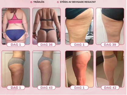 Elektrisk Koppningsmassage™