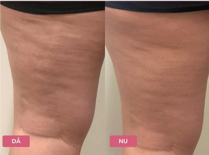 Elektrisk Koppningsmassage™